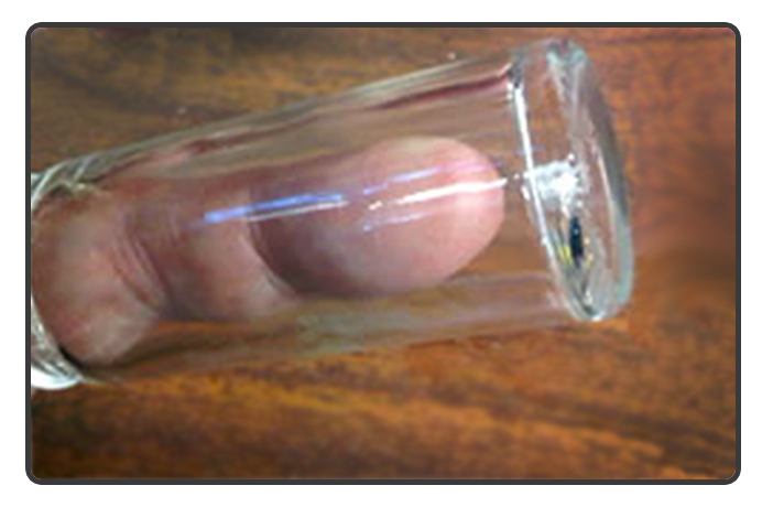 Pill Bottle Slide